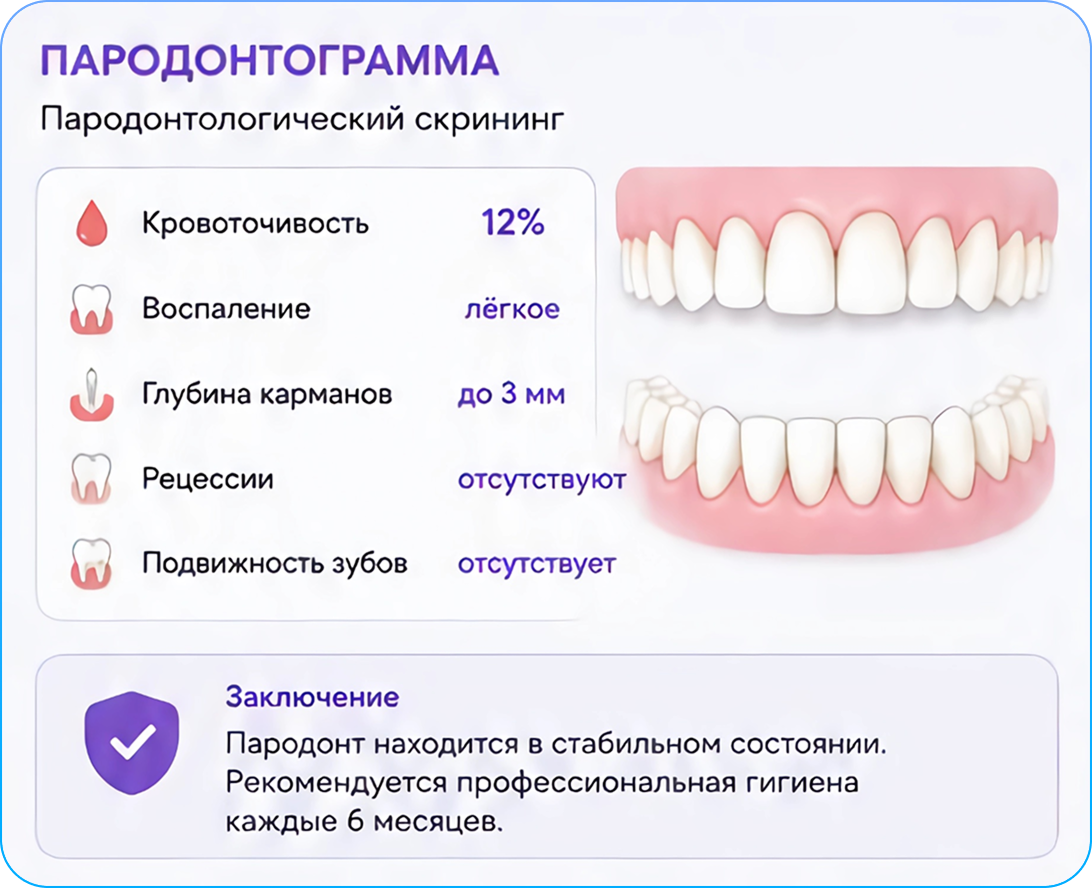Пародонтограмма